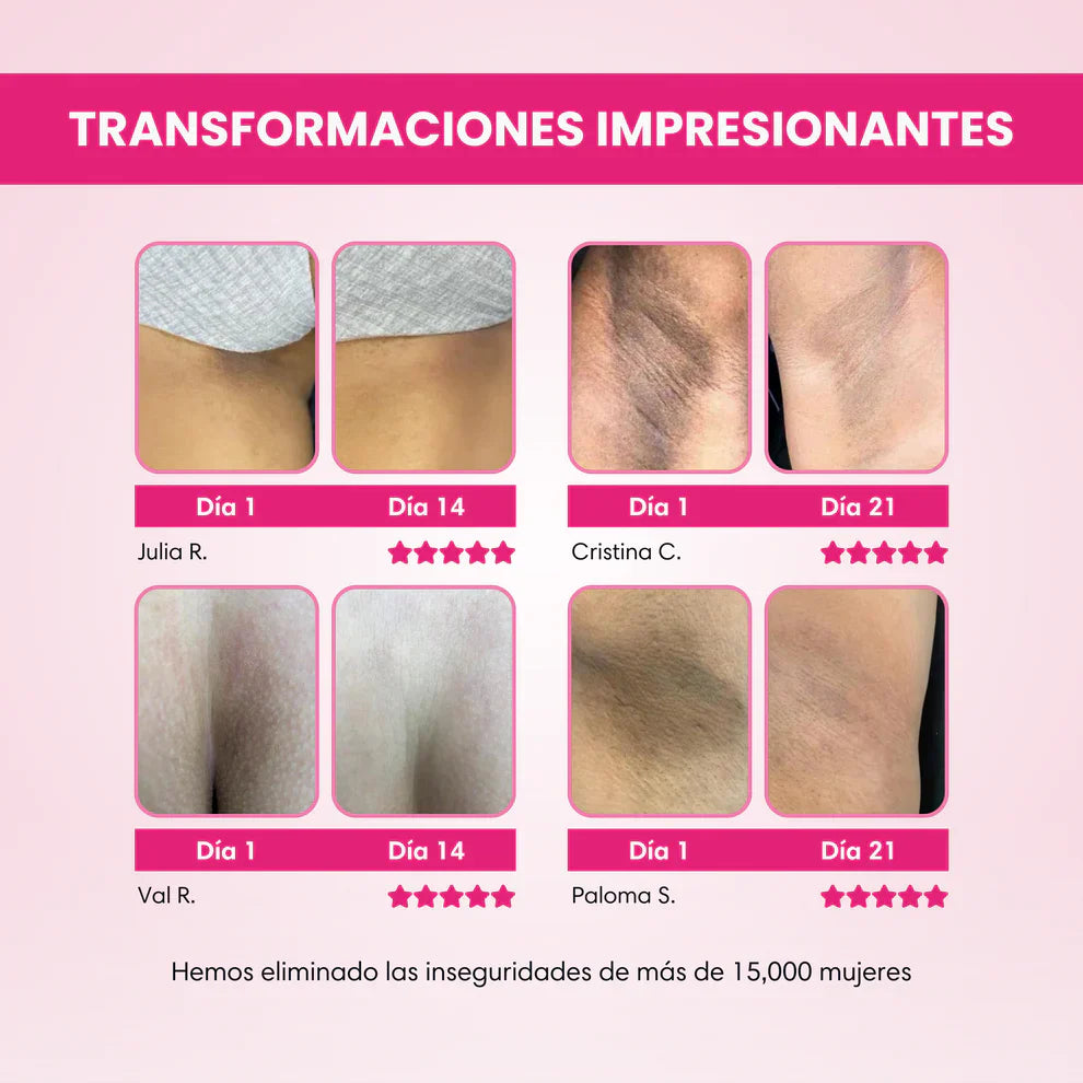 ✨ Crema Aclarante Skinglow®
